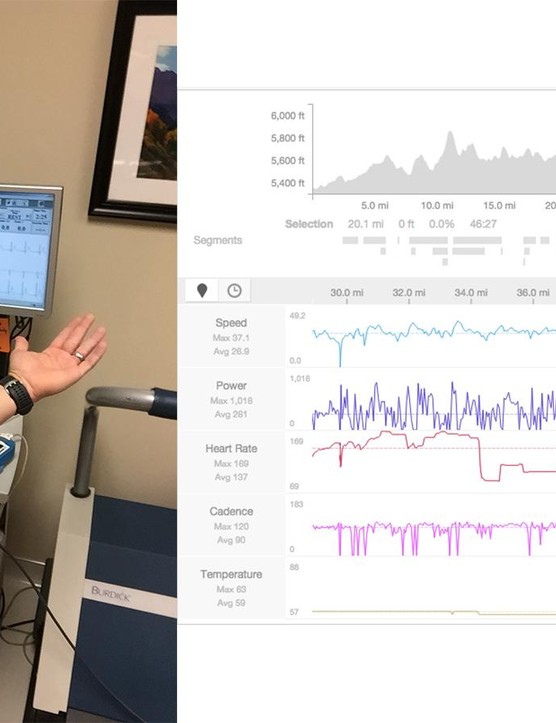 Après avoir constaté d'étranges fluctuations de mon rythme cardiaque lors de sorties difficiles, je suis allé le faire vérifier