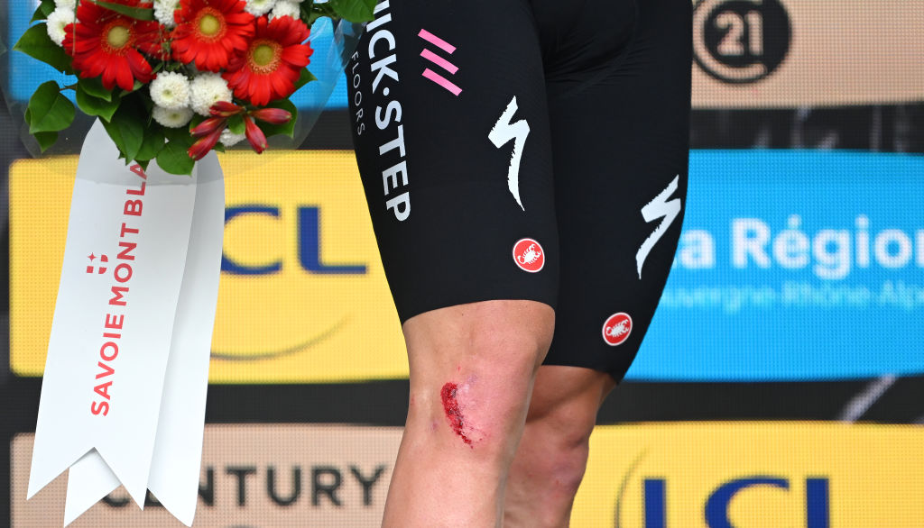 BOISSETSAINTPRIST FRANCE JUIN 06 Blessure aux jambes vue détaillée de Remco Evenepoel de Belgique et de l'équipe Soudal QuickStep célèbre sur le podium en tant que meilleur jeune vainqueur du maillot blanc lors du 76e Critérium du Dauphine 2024 Étape 5, une étape de 167 km d'Amplepuis à SaintPriest Course neutralisée en raison d'une chute de plusieurs coureurs et abandons UCIWT le 06 juin 2024 à BoissetSaintPriest France Photo de Dario BelingheriGetty Images