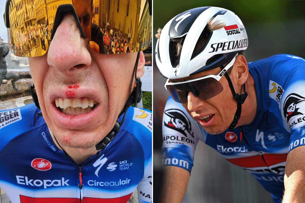 Jan Hirt broke three teeth before stage 1 of the Tour de France